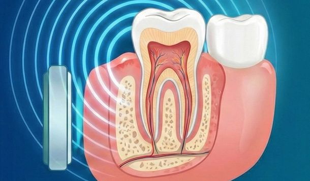 Moderne Magnetfeldtherapie