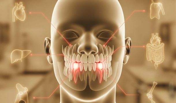 Schmerzfrei dank Störfelddiagnostik